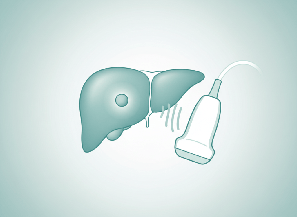 Ilustração do fígado com um pequeno nódulo destacado e um transdutor de ultrassom
