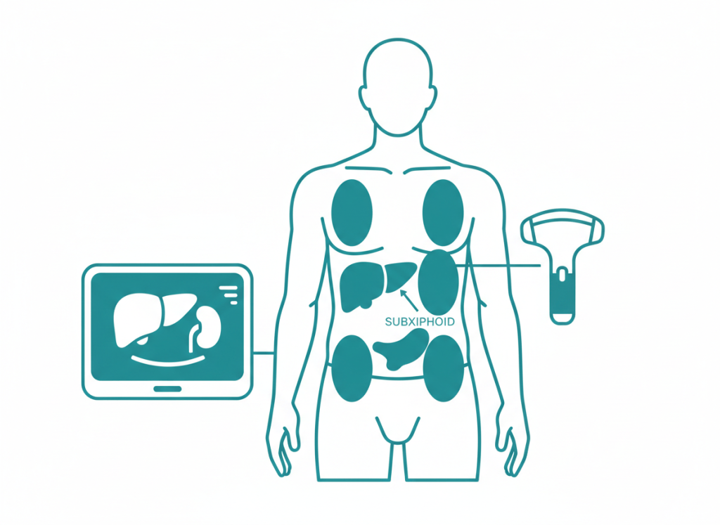 Ilustração de exame FAST e eFAST no trauma, com as posições do transdutor no abdome, na pelve, no coração e no tórax