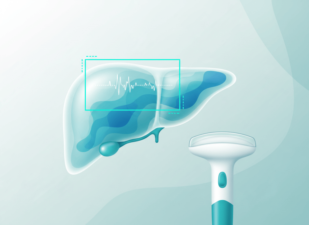 Quantificação de esteatose hepática no ultrassom: atenuação, HRI e&nbsp;CAP
