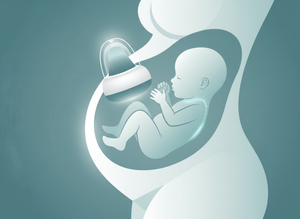 Ilustração de ultrassom do primeiro trimestre com feto de perfil e medida da translucência nucal