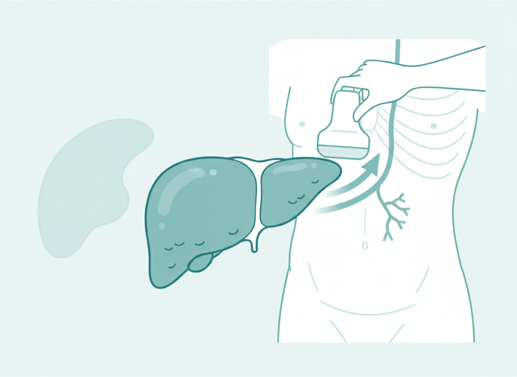 Ilustração de fígado com superfície irregular avaliado por transdutor de ultrassom, representando a cirrose