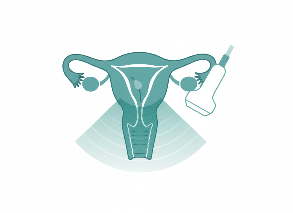 Ilustração médica de útero com mioma na parede e pólipo na cavidade ao lado de um transdutor de ultrassom, em tons de verde-azulado e branco